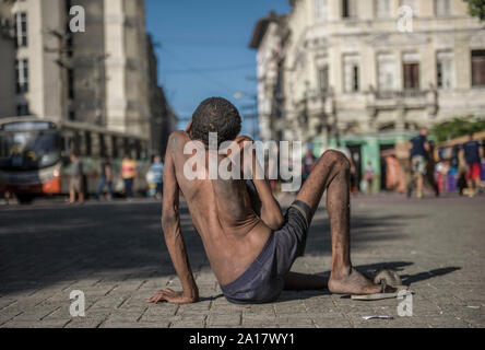 Uomo senza tetto con malattia congenita di Recife downtown Foto Stock