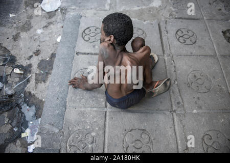 Uomo senza tetto con malattia congenita in un marciapiede di Recife downtown Foto Stock