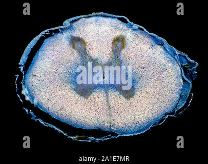 Fetale umana di midollo spinale TS, sezione macchiata, campo oscuro fotomicrografia Foto Stock