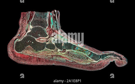 Fetale umana di sezione del piede che mostra la struttura generale, campo oscuro fotomicrografia Foto Stock