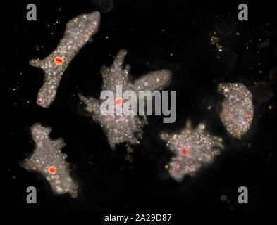 Amoeba fotomicrografia darkfield Foto Stock