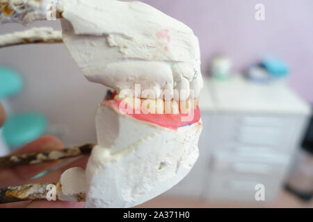 Protesi rimovibile nelle mani di un medico che lavora in uno studio dentistico Foto Stock