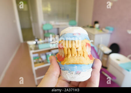 Protesi rimovibile nelle mani di un medico che lavora in uno studio dentistico Foto Stock