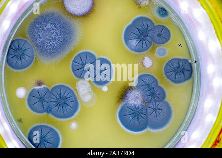 Colonia di funghi della pelle in una capsula di petri Foto Stock
