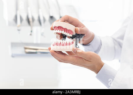 Le mani del dentista che mostra in plastica modello di ganascia Foto Stock