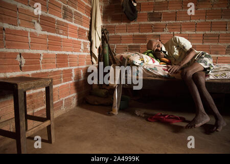 Barra de Aroeira, Santa Tereza do Tocantins, Tocantins Brasile - 6 Maggio 2016: afro-brasiliano uomo cieco con diverse disabilità che stabilisce nel suo letto. Foto Stock