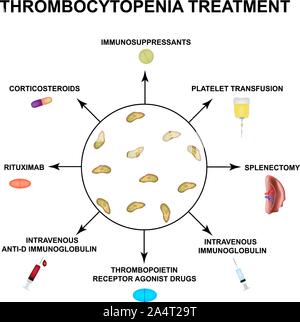 Il trattamento di trombocitopenia. Abbassamento delle piastrine nel sangue. Infographics. Illustrazione Vettoriale su sfondo isolato. Illustrazione Vettoriale