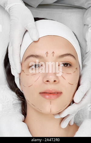 Close up di giovani volto femminile con linee nere. Professional cosmetologo chirurgico con dei segni di riferimento indicanti la linea di correzione. Le mani del medico in bianco Foto Stock