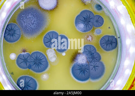 Colonia di funghi della pelle in una capsula di petri Foto Stock