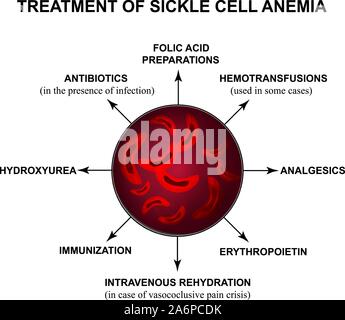 Il trattamento di anemia falciforme. Mondo Anemia falciforme giorno 19 giugno. Le cellule rosse del sangue. Gli eritrociti falciformi. Infographics. Illustrazione Vettoriale su Illustrazione Vettoriale