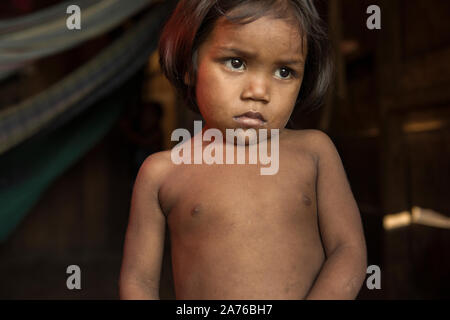 Breves, Para, Brasile - 04 agosto 2016: poveri indigeni brasiliani ragazza a casa, in riverside baraccopoli della città Breves, Foto Stock