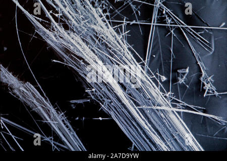 Microscopio elettronico a scansione di close-up immagine di un coleottero  Foto stock - Alamy