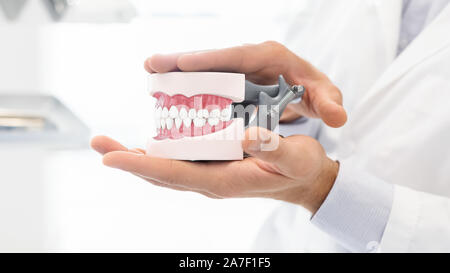 Le mani del dentista tenendo in plastica modello di ganascia Foto Stock