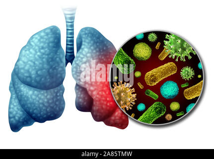 La polmonite infezione anatomia come un concetto medico come l'infiammazione dei polmoni umani infettati dal virus e batteri come una malattia polmonare diagnosi. Foto Stock