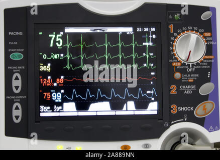 Monitor ECG Foto Stock