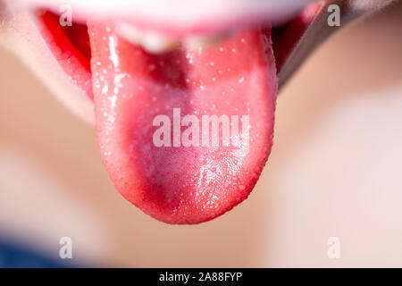 Lingua Di Un Bambino Con Scarlattina Fragola Lingua Foto Stock Alamy