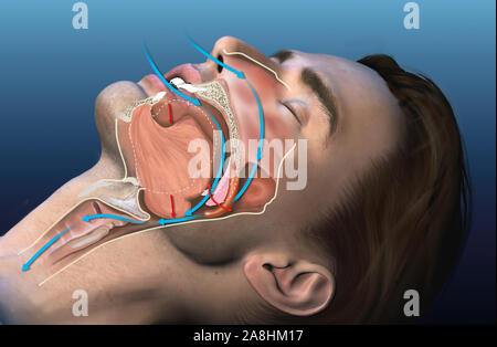 Dal punto di vista medico 3D illustrazione che mostra un sonno il russamento uomo Foto Stock