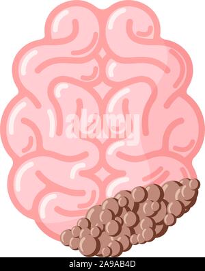 Cervello umano con cancro tumore. Malati subisca dei danni nel sistema nervoso centrale organo. Vettore illustrazione eps Illustrazione Vettoriale