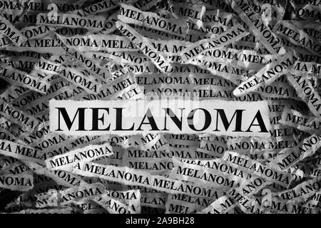 Il melanoma. Pezzi di carta strappati con le parole il melanoma. In bianco e nero. Close up. Foto Stock