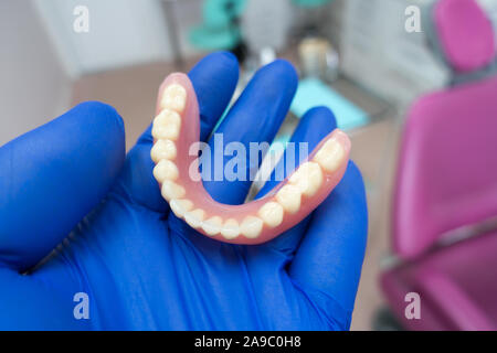 Protesi rimovibile nelle mani di un medico in guanti blu Foto Stock