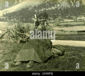 Una contadina con un enorme ciste Foto Stock