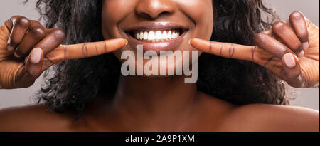 Irriconoscibile donna nera rivolta verso il suo Denti sani denti bianchi, primo piano Foto Stock