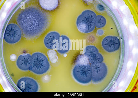 Colonia di funghi della pelle in una capsula di petri Foto Stock