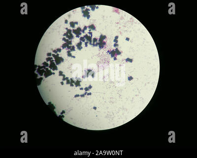 Immagine di Escherichia coli ottenuto attraverso un microscopio luminoso. Per qualsiasi purprose. Foto Stock