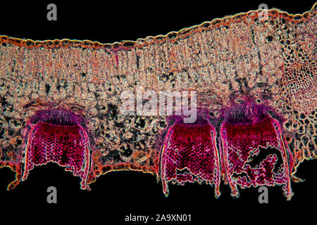 Aecidia in TS Berberis foglia, campo oscuro fotomicrografia Foto Stock