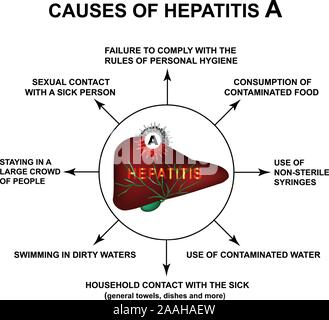 Cause di epatite A. Giornata Mondiale Epatite. Infographics. Illustrazione Vettoriale su sfondo isolato. Illustrazione Vettoriale