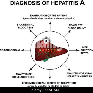 La diagnosi di epatite A. Giornata Mondiale Epatite. Infographics. Illustrazione Vettoriale su sfondo isolato. Illustrazione Vettoriale