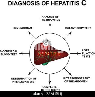 La diagnosi di infezione da epatite C. Giornata Mondiale Epatite. Infographics. Illustrazione Vettoriale su sfondo isolato. Illustrazione Vettoriale