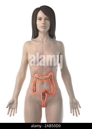 3d reso illustrazione di un'infiammazione del colon Foto Stock