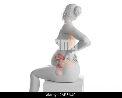 3D Rendering accurato dal punto di vista medico illustrazione di una donna in stato di gravidanza avente un mal di schiena Foto Stock