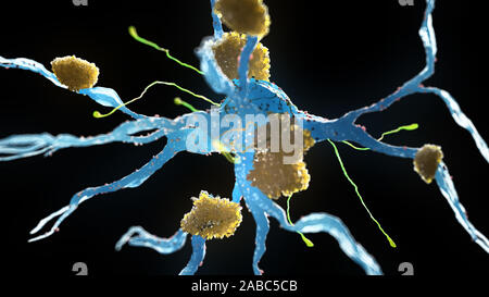Rendering 3d Illustrazione medica di cellule nervose affette da malattia di Alzheimer Foto Stock