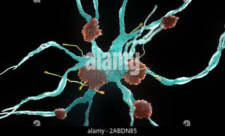Rendering 3d Illustrazione medica di cellule nervose affette da malattia di Alzheimer Foto Stock