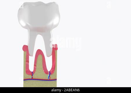 Estrazione molare. La perdita dei denti struttura anatomica. 3d Illustrazione medica. Foto Stock