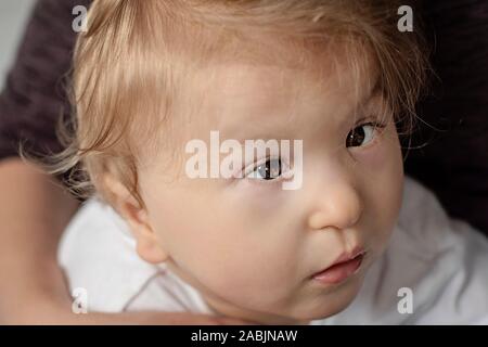 Ritratto di un bambino con paralisi cerebrale giacente sul letto. Esigenze speciali bambino. Disabili baby boy close-up. Bambino disabile. Foto Stock