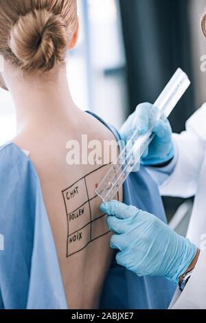 Vista ritagliata della holding allergist righello accanto la donna con marcata indietro Foto Stock