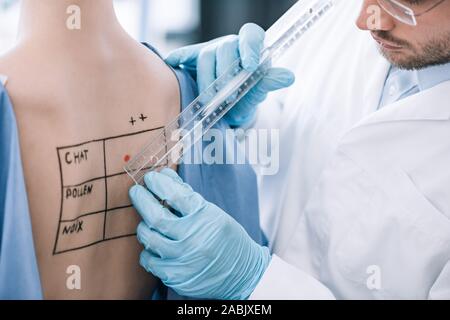 Vista ritagliata del barbuto allergist holding righello vicino al paziente con marcata indietro Foto Stock