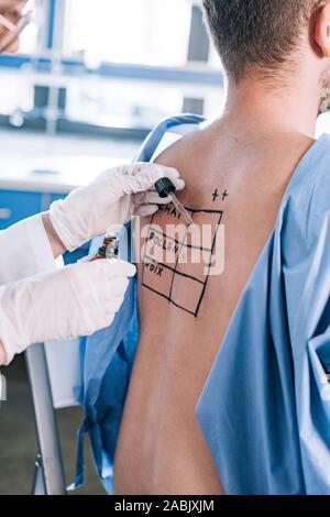 Vista ritagliata della holding allergist pipetta e bottiglia di vetro vicino all uomo con marcata indietro Foto Stock