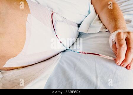 Dettaglio di un paziente respirare ossigeno attraverso una plastica cannula nasale ed una cannula endovenosa inserito nella mano. Foto Stock
