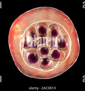 Plasmodium vivax all'interno di cellule rosse del sangue, illustrazione Foto Stock