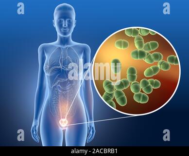 3D illustrazione che mostra Clostridium difficile batteri nell'intestino Foto Stock