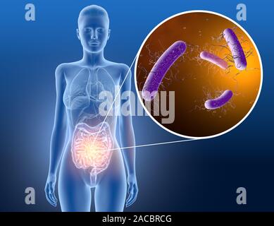 3D illustrazione che mostra Clostridium difficile batteri nell'intestino Foto Stock