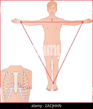 Posizionamento degli elettrodi ECG. Computer illustrazione che mostra la posizione  dei dieci elettrodi necessari per eseguire una derivazione 12  elettrocardiogramma (ECG) test. Sei elec Foto stock - Alamy