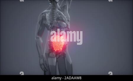 Intestino umano esame radiologico Foto Stock