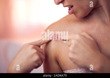 Donna cerca di schiacciare bollire sulla sua spalla. La gente, la medicina e la cura della pelle concept Foto Stock