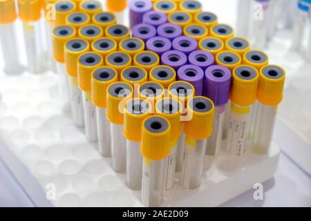 Messa a fuoco selettiva di un gruppo di medici tubo di campione di colore giallo e viola il colore , la provetta del campione di sangue per in laboratorio per diagnosticare la malattia del paziente è Foto Stock