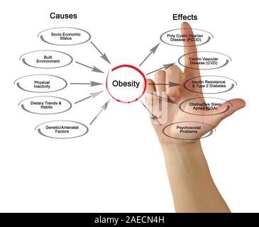 Obesità: cause ed effetti Foto Stock